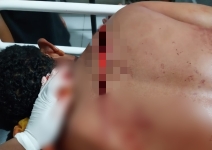 Pelaku Pembacokan Warga Totikum Diringkus Bersama Pacar